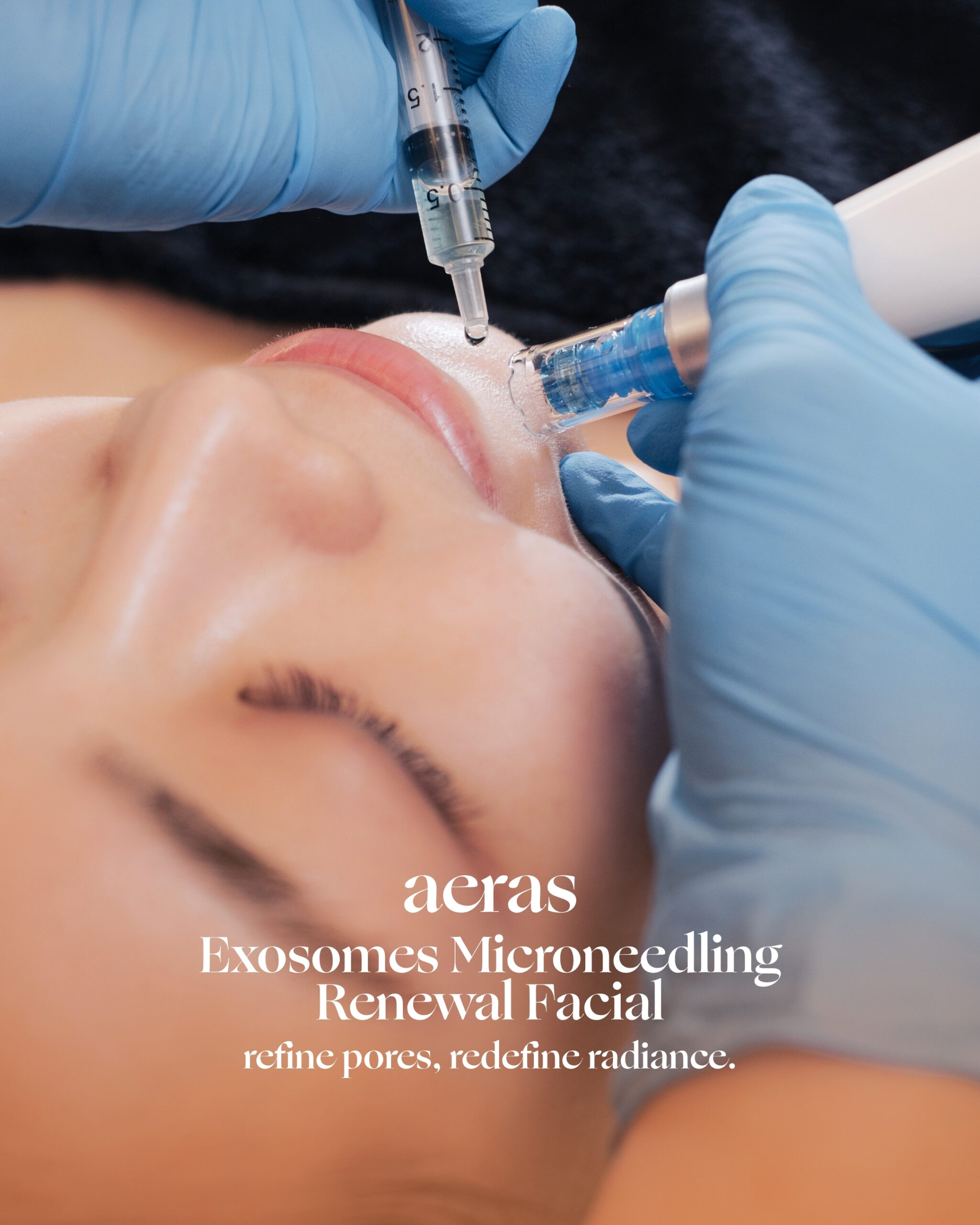 aeras exosomes microneedling renewal facial